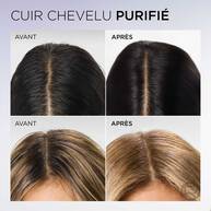 Hyaluron Pure  Serum Purifiant Cuir Chevelu Gras