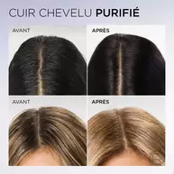 Hyaluron Pure  Serum Purifiant Cuir Chevelu Gras