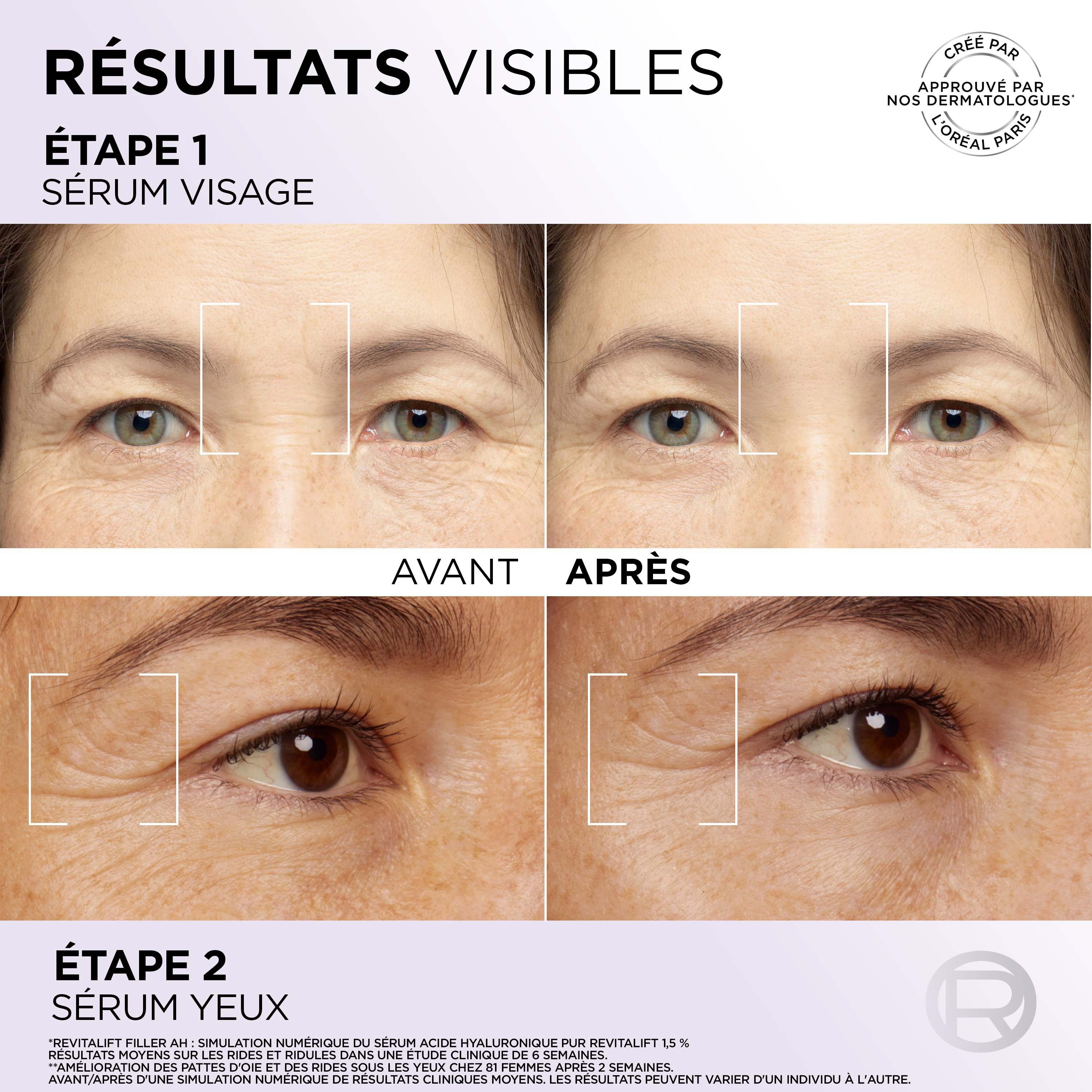 Routine Anti-Rides Filler a l'Acide hyaluronique