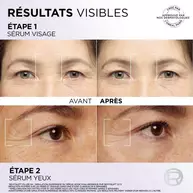 Revitalift Filler Serum Yeux
