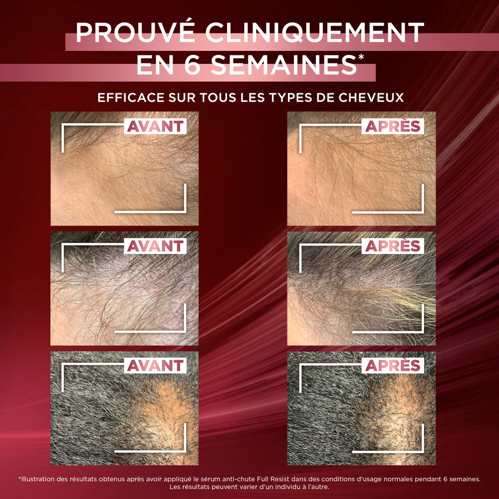 Elseve Full Resist Serum Anti-Chute