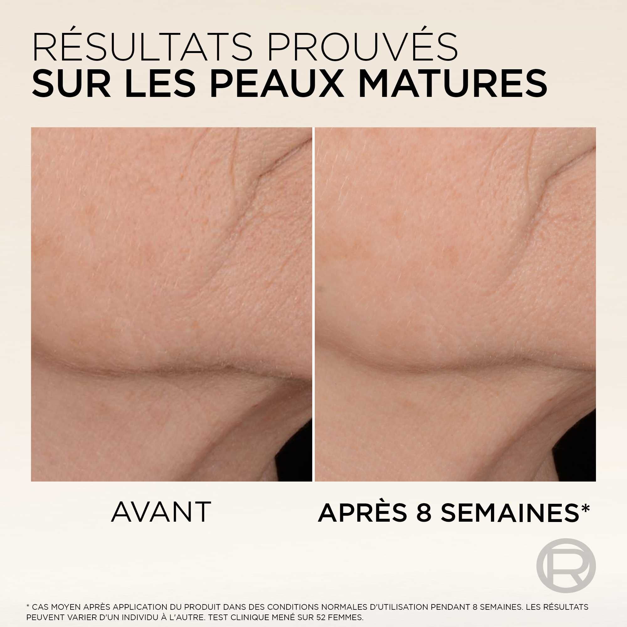 Photos comparatives "AVANT" et "APRES 8 SEMAINES" montrant une reduction visible des rides sur le cou et le decollete, avec le texte "RESULTATS PROUVES SUR LES PEAUX MATURES".