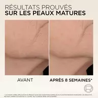 Photos comparatives "AVANT" et "APRES 8 SEMAINES" montrant une reduction visible des rides sur le cou et le decollete, avec le texte "RESULTATS PROUVES SUR LES PEAUX MATURES".