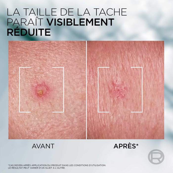 Men Expert Derma Control Pate S.O.S Anti-Imperfections Niacinamide