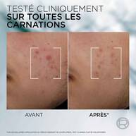 Men Expert Derma Control  Serum Anti-Imperfections Niacinamide