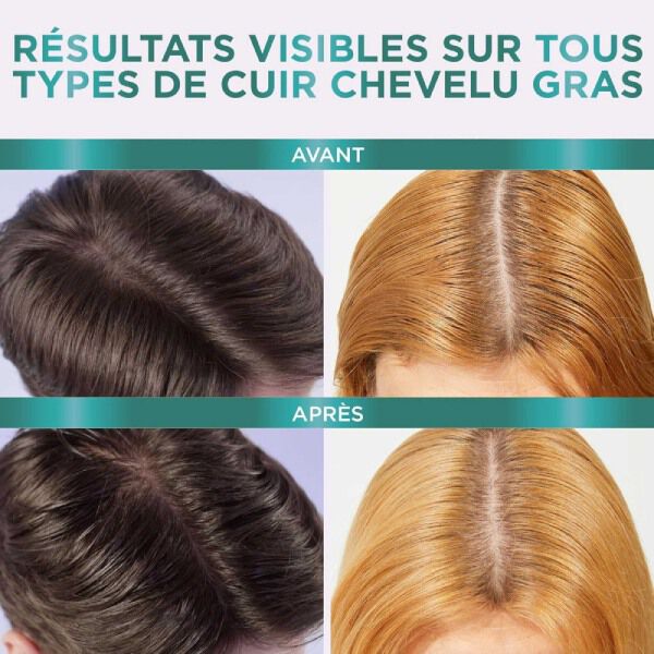 Hyaluron Pure  Serum Purifiant Cuir Chevelu Gras