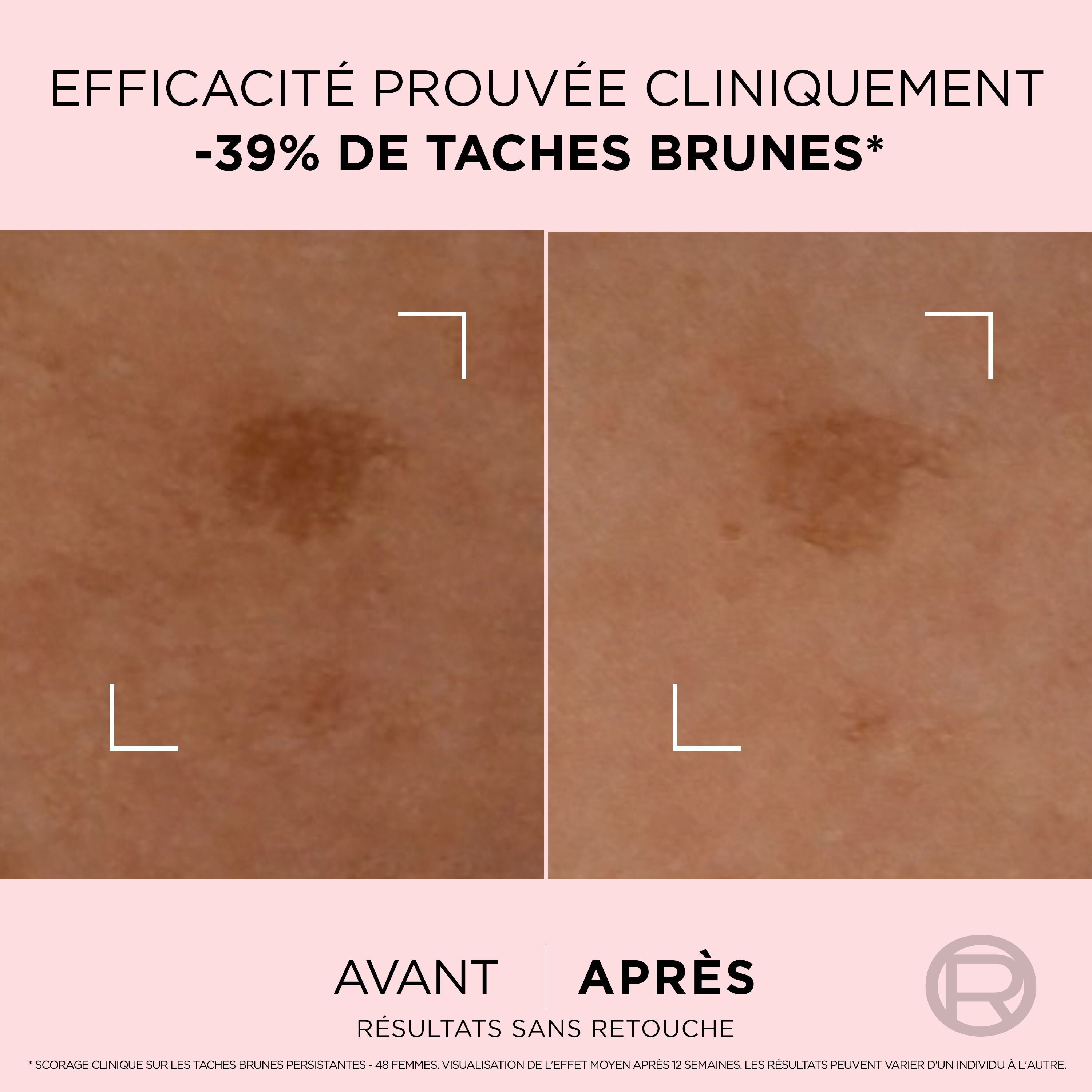 Age Perfect Golden Age​<br> Serum Correcteur Taches Brunes